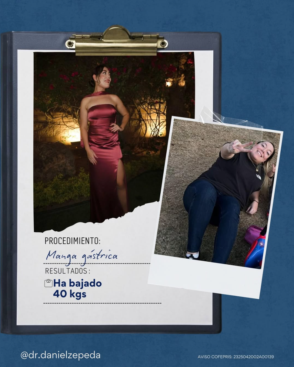 Testimonio manga gástrica −40 kg