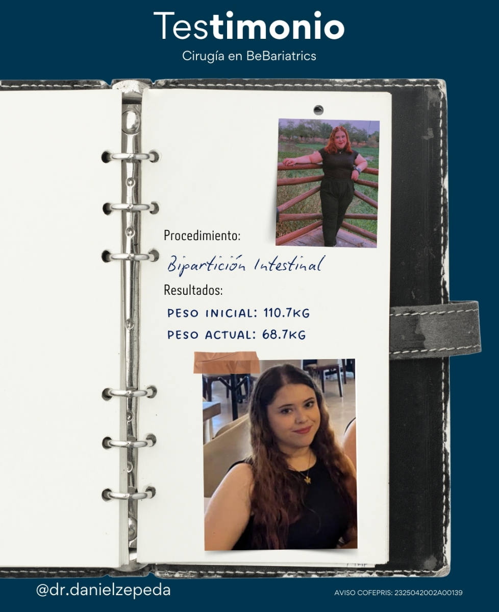 Testimonio bipartición intestinal 110.7 kg → 68.7 kg