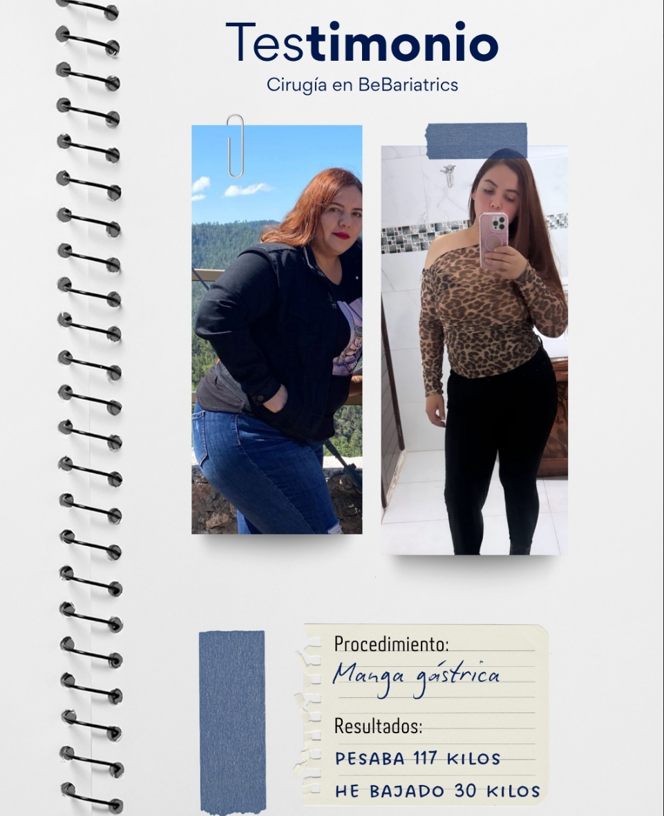 Testimonio manga gástrica −30 kg